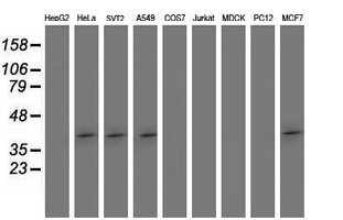 SETD7 / SET7 Antibody - Western blot of extracts (35 ug) from 9 different cell lines by using anti-SETD7 monoclonal antibody (HepG2: human; HeLa: human; SVT2: mouse; A549: human; COS7: monkey; Jurkat: human; MDCK: canine; PC12: rat; MCF7: human).