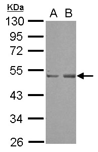 SETD7 / SET7 Antibody - Sample (30 ug of whole cell lysate) A: A549 B: HeLa 10% SDS PAGE SETD7 / SET7 antibody diluted at 1:1000