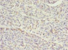 SETD7 / SET7 Antibody - Immunohistochemistry of paraffin-embedded human pancreatic tissue at dilution 1:100