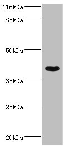 SETD7 / SET7 Antibody - Western blot All Lanes:SETD7 antibody at 4ug/ml+MCF-7 whole cell lysate Secondary Goat polyclonal to rabbit at 1/10000 dilution Predicted band size: 41kDa Observed band size: 41kDa