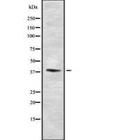 SETD7 / SET7 Antibody - Western blot analysis SETD7 using Jurkat whole cells lysates