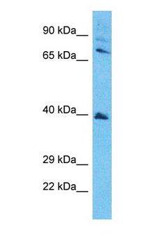 SETD7 / SET7 Antibody - Western blot of SETD7 Antibody with human Jurkat Whole Cell lysate.  This image was taken for the unconjugated form of this product. Other forms have not been tested.