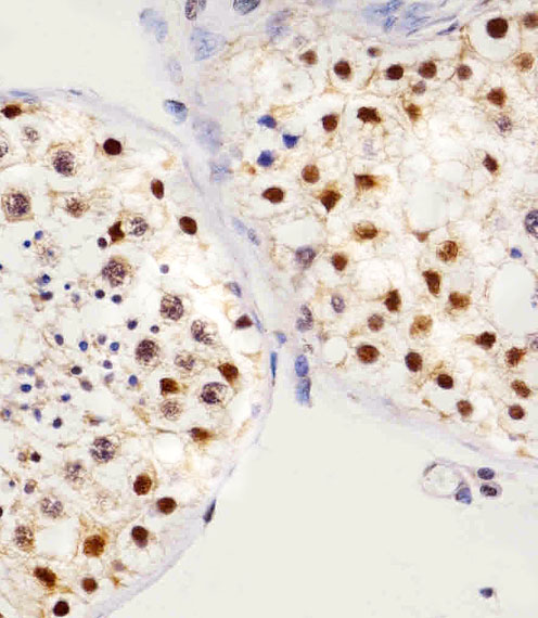 SETD8 / SET8 Antibody - Immunohistochemical of paraffin-embedded H. testis section using SET07 Antibody. Antibody was diluted at 1:25 dilution. A peroxidase-conjugated goat anti-rabbit IgG at 1:400 dilution was used as the secondary antibody, followed by DAB staining.