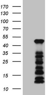 SETD8 / SET8 Antibody - HEK293T cells were transfected with the pCMV6-ENTRY control. (Left lane) or pCMV6-ENTRY SETD8. (Right lane) cDNA for 48 hrs and lysed. Equivalent amounts of cell lysates. (5 ug per lane) were separated by SDS-PAGE and immunoblotted with anti-SETD8. (1:2000)