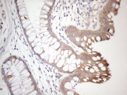 SETD8 / SET8 Antibody - Immunohistochemical staining of paraffin-embedded Human colon tissue within the normal limits using anti-SETD8 mouse monoclonal antibody. (Heat-induced epitope retrieval by 1mM EDTA in 10mM Tris buffer. (pH8.5) at 120°C for 3 min. (1:150)