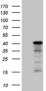 SETD8 / SET8 Antibody - HEK293T cells were transfected with the pCMV6-ENTRY control. (Left lane) or pCMV6-ENTRY SETD8. (Right lane) cDNA for 48 hrs and lysed