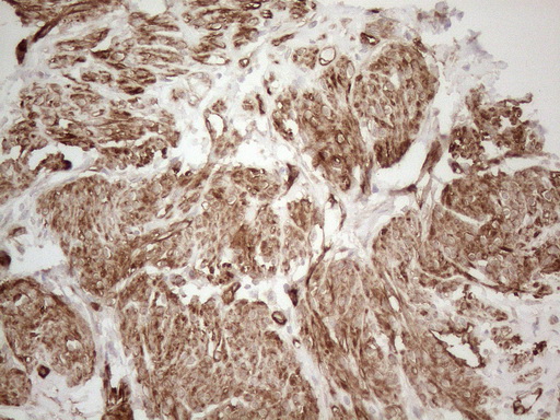 SETD8 / SET8 Antibody - Immunohistochemical staining of paraffin-embedded Human endometrium tissue within the normal limits using anti-SETD8 mouse monoclonal antibody. (Heat-induced epitope retrieval by 1mM EDTA in 10mM Tris buffer. (pH8.5) at 120°C for 3 min. (1:150)