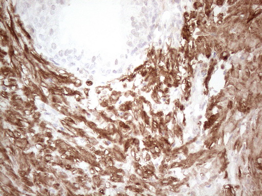 SETD8 / SET8 Antibody - Immunohistochemical staining of paraffin-embedded Human prostate tissue within the normal limits using anti-SETD8 mouse monoclonal antibody. (Heat-induced epitope retrieval by 1mM EDTA in 10mM Tris buffer. (pH8.5) at 120°C for 3 min. (1:150)