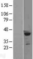 SETD8 / SET8 Protein - Western validation with an anti-DDK antibody * L: Control HEK293 lysate R: Over-expression lysate