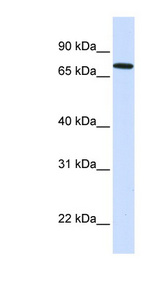 SETDB2 Antibody - SETDB2 antibody Western blot of Placenta lysate. This image was taken for the unconjugated form of this product. Other forms have not been tested.