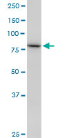 SETDB2 Antibody - SETDB2 monoclonal antibody (M17), clone 2F4. Western blot of SETDB2 expression in A-431.