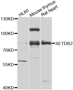 SETDB2 Antibody - Western blot analysis of extracts of various cell lines.