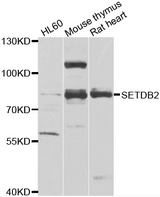 SETDB2 Antibody - Western blot analysis of extracts of various cell lines.