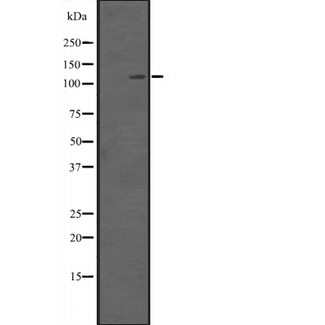 SETDB2 Antibody - Western blot analysis of SETDB2 expression in HEK293 cells. The lane on the left is treated with the antigen-specific peptide.