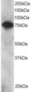 SETMAR Antibody - Antibody staining (2 ug/ml) of Daudi lysate (RIPA buffer, 30 ug total protein per lane). Primary incubated for 12 hour. Detected by Western blot of chemiluminescence.