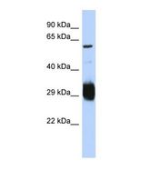SETMAR Antibody - Western blot of Human Jurkat. SETMAR antibody dilution 1.0 ug/ml.  This image was taken for the unconjugated form of this product. Other forms have not been tested.