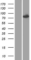 SETMAR Protein - Western validation with an anti-DDK antibody * L: Control HEK293 lysate R: Over-expression lysate