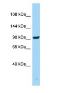 SEZ6 / SEZ-6 Antibody - SEZ6 / SEZ-6 antibody Western Blot of PANC1.  This image was taken for the unconjugated form of this product. Other forms have not been tested.