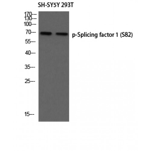 SF1 Antibody - Western blot of Phospho-Splicing factor 1 (S82) antibody