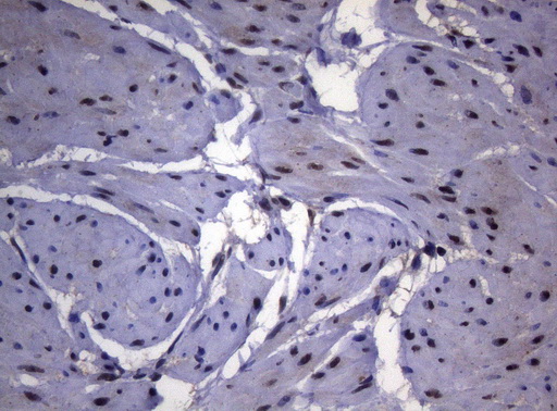 SF1 Antibody - Immunohistochemical staining of paraffin-embedded Human bladder tissue within the normal limits using anti-SF1 mouse monoclonal antibody. (Heat-induced epitope retrieval by 1mM EDTA in 10mM Tris buffer. (pH8.5) at 120°C for 3 min. (1:150)