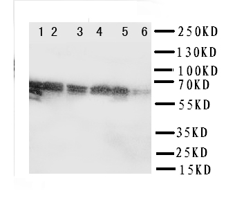 SF1 Antibody - WB of SF1 antibody. Lane 1: Rat Spleen Tissue Lysate. Lane 2: Rat Liver Tissue Lysate. Lane 3: PANC Cell Lysate. Lane 4: COLO320 Cell Lysate. Lane 5: SW620 Cell Lysate. Lane 6: SKOV Cell Lysate.