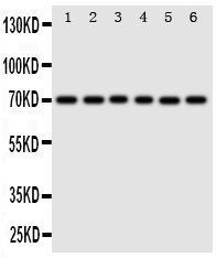 SF1 Antibody - Anti-splicing factor 1 antibody, Western blotting All lanes: Anti splicing factor 1 at 0.5ug/ml Lane 1: Rat Spleen Tissue Lysate at 50ugLane 2: Rat Liver Tissue Lysate at 50ugLane 3: PANC Whole Cell Lysate at 40ugLane 4: COLO320 Whole Cell Lysate at 40ugLane 5: SW620 Whole Cell Lysate at 40ugLane 6: SKOV Whole Cell Lysate at 40ugPredicted bind size: 52KD Observed bind size: 70KD