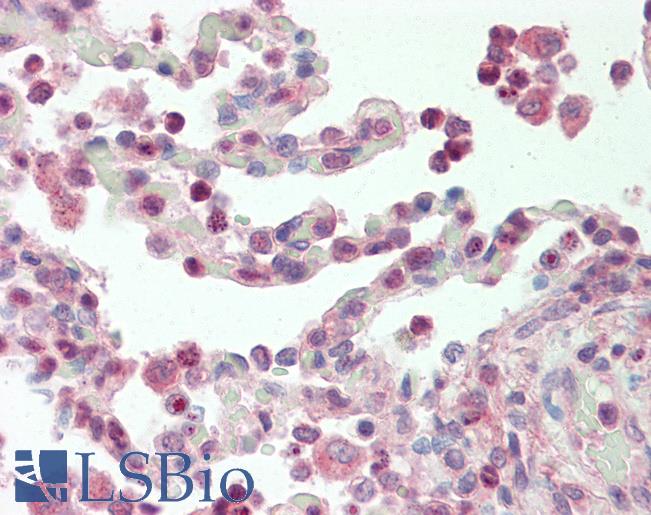 SF1 Antibody - Anti-SF1 antibody IHC staining of human lung. Immunohistochemistry of formalin-fixed, paraffin-embedded tissue after heat-induced antigen retrieval. Antibody concentration 10 ug/ml.  This image was taken for the unconjugated form of this product. Other forms have not been tested.