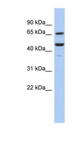 SF1 Antibody - SF1 antibody Western blot of COLO205 cell lysate.  This image was taken for the unconjugated form of this product. Other forms have not been tested.