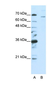 SF1 Antibody - SF1 antibody Western blot of HepG2 cell lysate. This image was taken for the unconjugated form of this product. Other forms have not been tested.