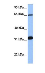 SF1 Antibody - Jurkat cell lysate. Antibody concentration: 1.0 ug/ml. Gel concentration: 12%.  This image was taken for the unconjugated form of this product. Other forms have not been tested.