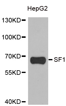 SF1 Antibody - Western blot analysis of extracts of HepG2 cells.