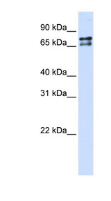 SF1 Antibody - SF1 antibody Western blot of Transfected 293T cell lysate. This image was taken for the unconjugated form of this product. Other forms have not been tested.