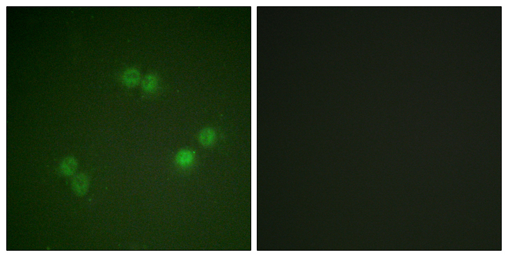 SF1 Antibody - Immunofluorescence analysis of A549 cells, using SF1 (Phospho-Ser82) Antibody. The picture on the right is blocked with the phospho peptide.