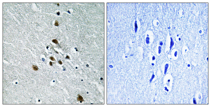 SF1 Antibody - Immunohistochemistry analysis of paraffin-embedded human brain, using SF1 (Phospho-Ser82) Antibody. The picture on the right is blocked with the phospho peptide.