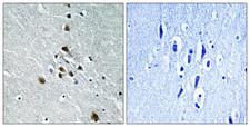 SF1 Antibody - Immunohistochemistry analysis of paraffin-embedded human brain, using SF1 (Phospho-Ser82) Antibody. The picture on the right is blocked with the phospho peptide.