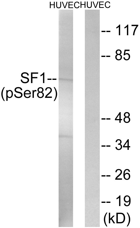 SF1 Antibody - Western blot analysis of lysates from HUVEC cells treated with anisomycin 25ug/ml 30', using SF1 (Phospho-Ser82) Antibody. The lane on the right is blocked with the phospho peptide.