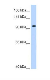 SF3A1 / SF3A120 Antibody - 721_B cell lysate. Antibody concentration: 0.25 ug/ml. Gel concentration: 8%.  This image was taken for the unconjugated form of this product. Other forms have not been tested.