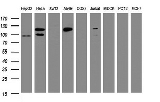 SF3A1 / SF3A120 Antibody - Western blot of extracts (35 ug) from 9 different cell lines by using g anti-SF3A1 monoclonal antibody (HepG2: human; HeLa: human; SVT2: mouse; A549: human; COS7: monkey; Jurkat: human; MDCK: canine; PC12: rat; MCF7: human).
