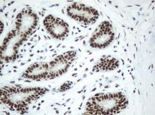 SF3A1 / SF3A120 Antibody - IHC of paraffin-embedded Human breast tissue using anti-SF3A1 mouse monoclonal antibody.