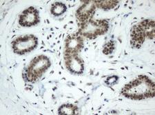 SF3A1 / SF3A120 Antibody - IHC of paraffin-embedded Human breast tissue using anti-SF3A1 mouse monoclonal antibody. (Heat-induced epitope retrieval by 10mM citric buffer, pH6.0, 120°C for 3min).