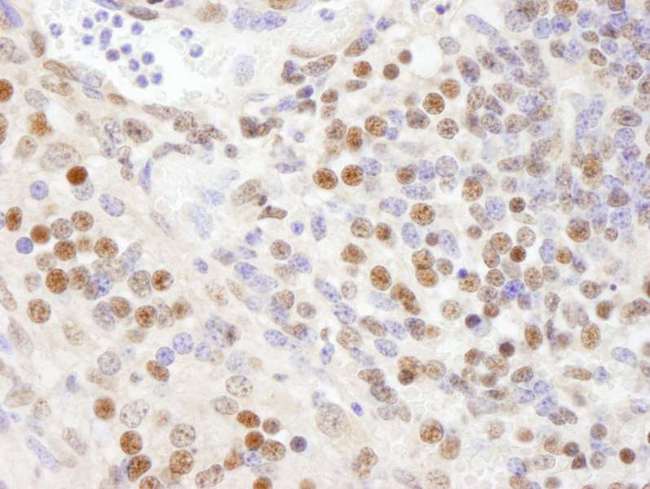 SF3A1 / SF3A120 Antibody - Detection of Mouse SF3a120/SAP114 by Immunohistochemistry. Sample: FFPE section of mouse teratoma. Antibody: Affinity purified rabbit anti-SF3a120/SAP114 used at a dilution of 1:100.