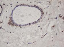 SF3A1 / SF3A120 Antibody - IHC of paraffin-embedded Human breast tissue using anti-SF3A1 mouse monoclonal antibody.