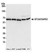 SF3A2 / SF3a66 Antibody - Detection of human and mouse SF3A2/SAP62 by western blot. Samples: Whole cell lysate (50 µg) from HeLa, HEK293T, Jurkat, mouse TCMK-1, and mouse NIH 3T3 cells prepared using NETN lysis buffer. Antibody: Affinity purified rabbit anti-SF3A2/SAP62 antibody used for WB at 0.04 µg/ml. Detection: Chemiluminescence with an exposure time of 10 seconds.