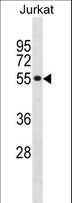 SF3A2 / SF3a66 Antibody - SF3A2 Antibody western blot of Jurkat cell line lysates (35 ug/lane). The SF3A2 antibody detected the SF3A2 protein (arrow).