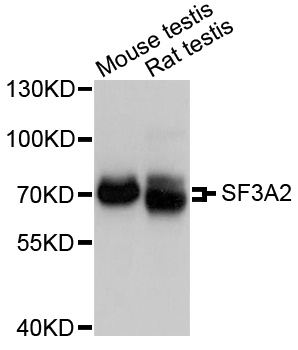 SF3A2 / SF3a66 Antibody - Western blot analysis of extracts of various cell lines.