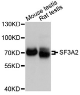SF3A2 / SF3a66 Antibody - Western blot analysis of extracts of various cell lines.