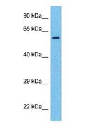 SF3A2 / SF3a66 Antibody - Western blot of SF3A2 Antibody with human MDA-MB-435s Whole Cell lysate.  This image was taken for the unconjugated form of this product. Other forms have not been tested.
