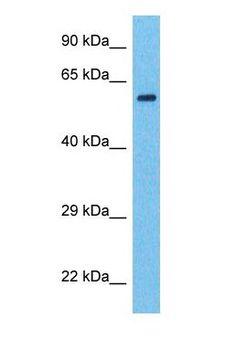SF3A2 / SF3a66 Antibody - Western blot of SF3A2 Antibody with human MDA-MB-435s Whole Cell lysate.  This image was taken for the unconjugated form of this product. Other forms have not been tested.