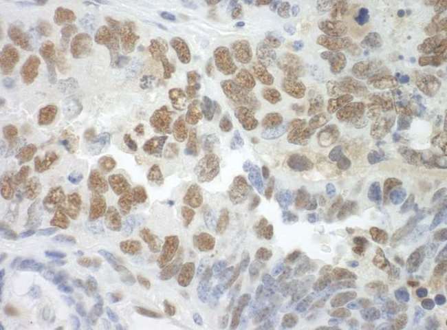 SF3A3 / SF3a60 Antibody - Detection of Mouse SF3A3 by Immunohistochemistry. Sample: FFPE section of mouse teratoma. Antibody: Affinity purified rabbit anti-SF3A3 used at a dilution of 1:250.