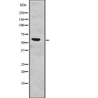 SF3A3 / SF3a60 Antibody - Western blot analysis of SF3A3 expression in human fetal liver tissue lysates. The lane on the left is treated with the antigen-specific peptide.